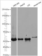 SYAP1 Antibody in Western Blot (WB)