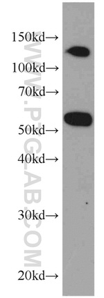 SYAP1 Antibody in Western Blot (WB)