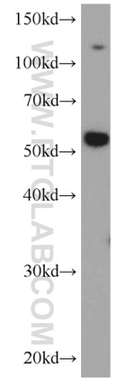 SYAP1 Antibody in Western Blot (WB)