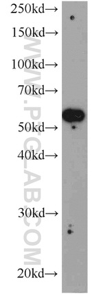 SYAP1 Antibody in Western Blot (WB)