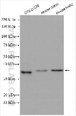 DHRS1 Antibody in Western Blot (WB)