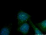 CEP70 Antibody in Immunocytochemistry (ICC/IF)