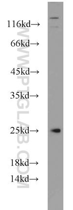 CEP70 Antibody in Western Blot (WB)