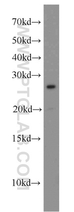 CEP70 Antibody in Western Blot (WB)