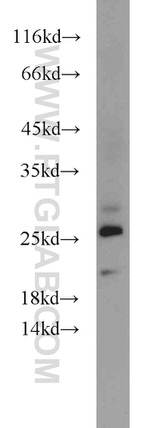 CEP70 Antibody in Western Blot (WB)
