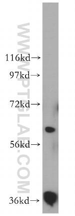 RDH14 Antibody in Western Blot (WB)