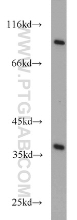 RDH14 Antibody in Western Blot (WB)
