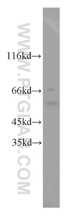 MYC-tag Antibody in Western Blot (WB)
