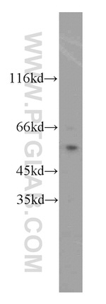 MYC-tag Antibody in Western Blot (WB)
