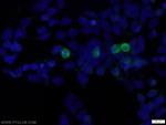 MYC-tag Antibody in Immunocytochemistry (ICC/IF)