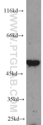 MYC-tag Antibody in Western Blot (WB)
