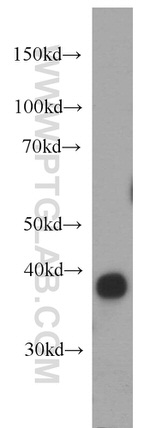 MRPS31 Antibody in Western Blot (WB)