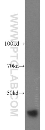 MRPS31 Antibody in Western Blot (WB)