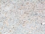 HOIP Antibody in Immunohistochemistry (Paraffin) (IHC (P))