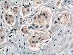 HOIP Antibody in Immunohistochemistry (Paraffin) (IHC (P))