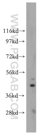 ARC/ARG3.1 Antibody in Western Blot (WB)