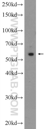ARC/ARG3.1 Antibody in Western Blot (WB)