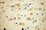 ARC/ARG3.1 Antibody in Immunohistochemistry (Paraffin) (IHC (P))