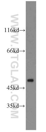 ARC/ARG3.1 Antibody in Western Blot (WB)