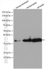 NT5C3L Antibody in Western Blot (WB)