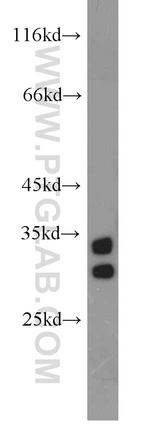NT5C3L Antibody in Western Blot (WB)