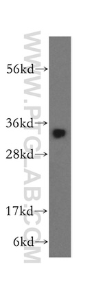 NT5C3L Antibody in Western Blot (WB)