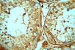 CDC37L1 Antibody in Immunohistochemistry (Paraffin) (IHC (P))