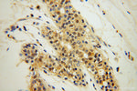 SPAG7 Antibody in Immunohistochemistry (Paraffin) (IHC (P))