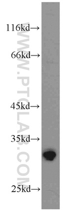 SPAG7 Antibody in Western Blot (WB)