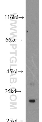 SPAG7 Antibody in Western Blot (WB)
