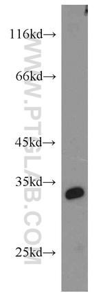 SPAG7 Antibody in Western Blot (WB)