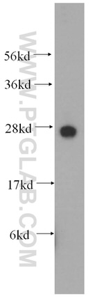 GHITM Antibody in Western Blot (WB)