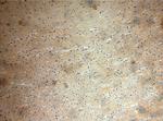 GHITM Antibody in Immunohistochemistry (Paraffin) (IHC (P))