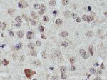 GHITM Antibody in Immunohistochemistry (Paraffin) (IHC (P))