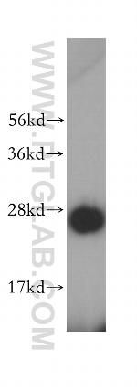 GHITM Antibody in Western Blot (WB)
