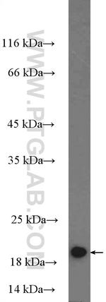 MRPL22 Antibody in Western Blot (WB)