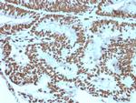 Zinc Finger Protein 846/ZNF846 Antibody in Immunohistochemistry (Paraffin) (IHC (P))