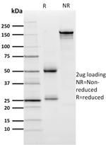 Zinc Finger Protein 846/ZNF846 Antibody in SDS-PAGE (SDS-PAGE)