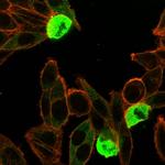 Zinc Finger Protein 846/ZNF846 Antibody in Immunocytochemistry (ICC/IF)