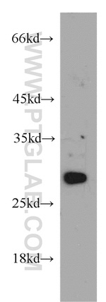 HSD17B11 Antibody in Western Blot (WB)