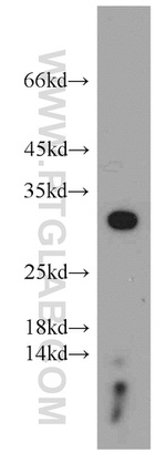 HSD17B11 Antibody in Western Blot (WB)