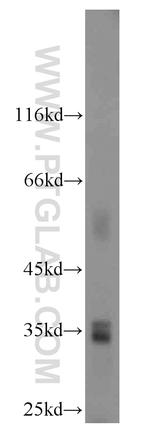 HSD17B11 Antibody in Western Blot (WB)