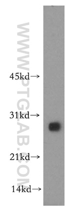 HSD17B11 Antibody in Western Blot (WB)