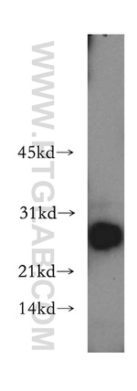 HSD17B11 Antibody in Western Blot (WB)