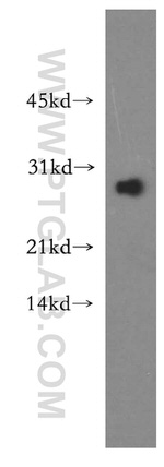 HSD17B11 Antibody in Western Blot (WB)