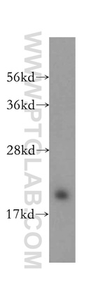 CHAC2 Antibody in Western Blot (WB)