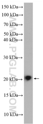 CHAC2 Antibody in Western Blot (WB)
