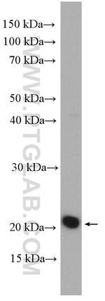 CHAC2 Antibody in Western Blot (WB)