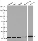 TST Antibody in Western Blot (WB)