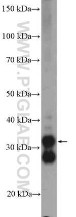 TST Antibody in Western Blot (WB)